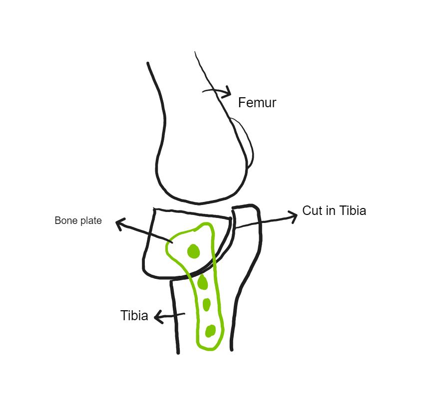 TPLO Surgery Figure 2 - TPLO Surgery